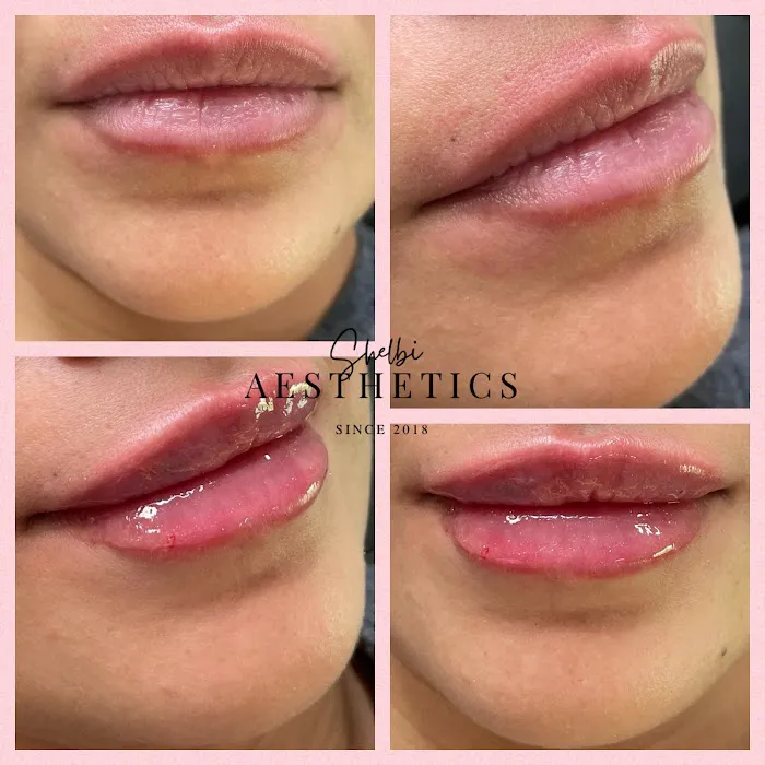Shelbi Aesthetics and Wellness Picture 6
