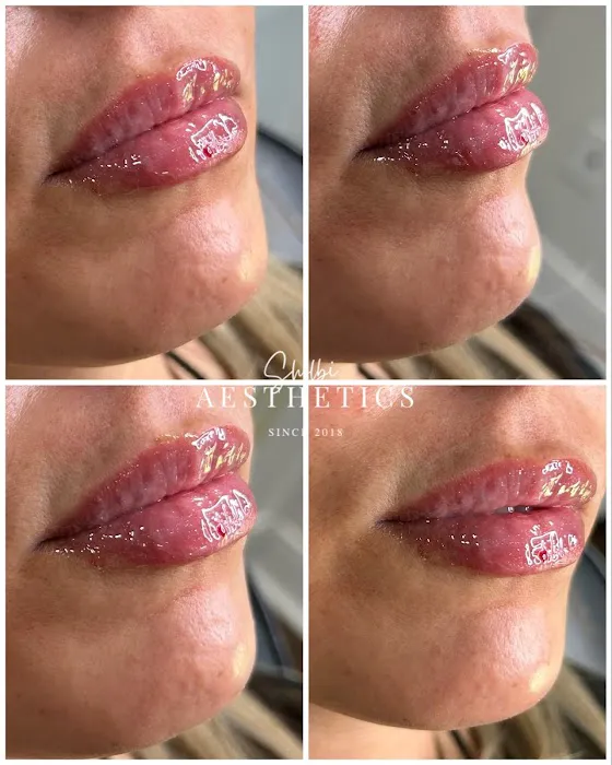 Shelbi Aesthetics and Wellness Picture 8