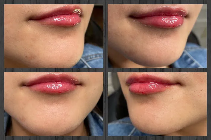 Shelbi Aesthetics and Wellness Picture 7