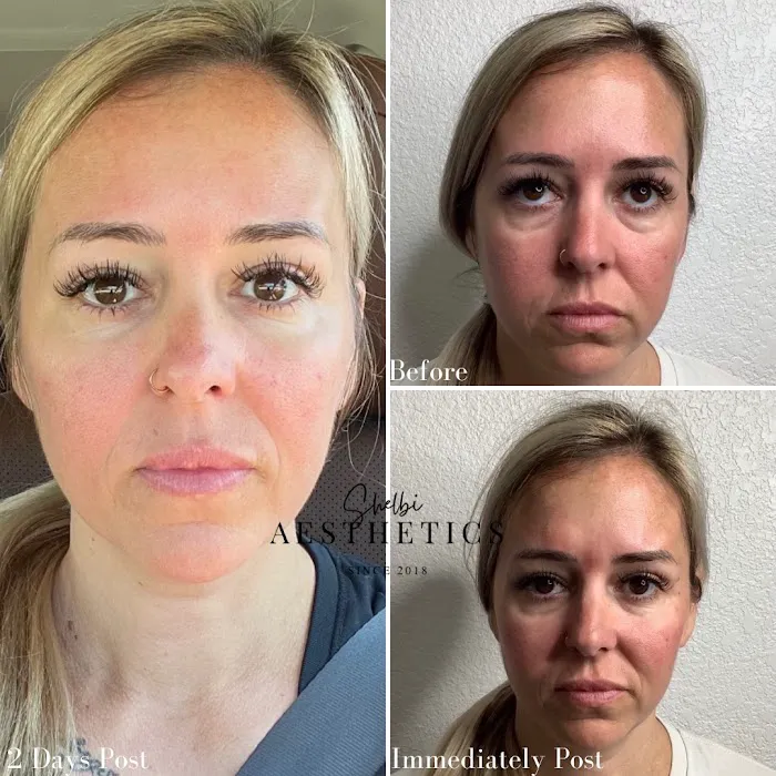 Shelbi Aesthetics and Wellness Picture 9