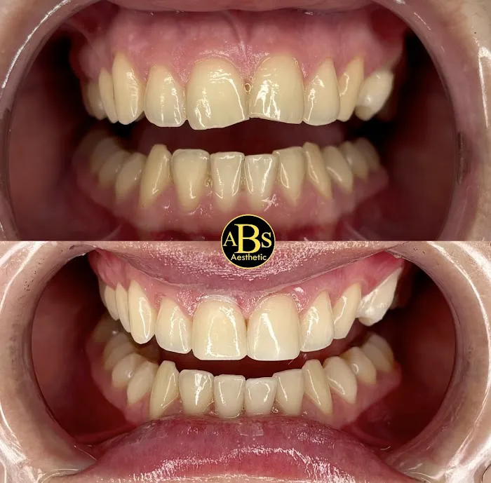 ABS medical aesthetic Picture 4