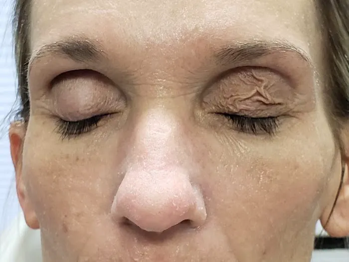 Renew You Esthetics Picture 9