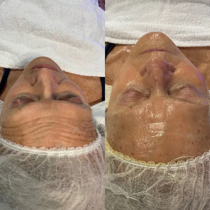 Standard Beauty Aesthetic Picture 7