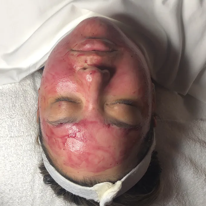 New Aura AestheTX Picture 9