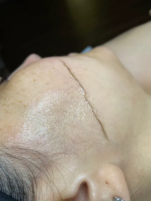 New Aura AestheTX Picture 1