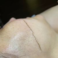 New Aura AestheTX ico