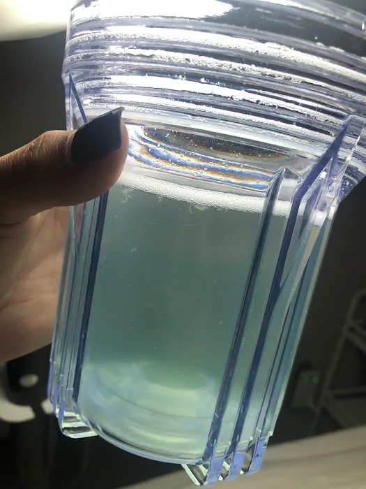 New Aura AestheTX Picture 2