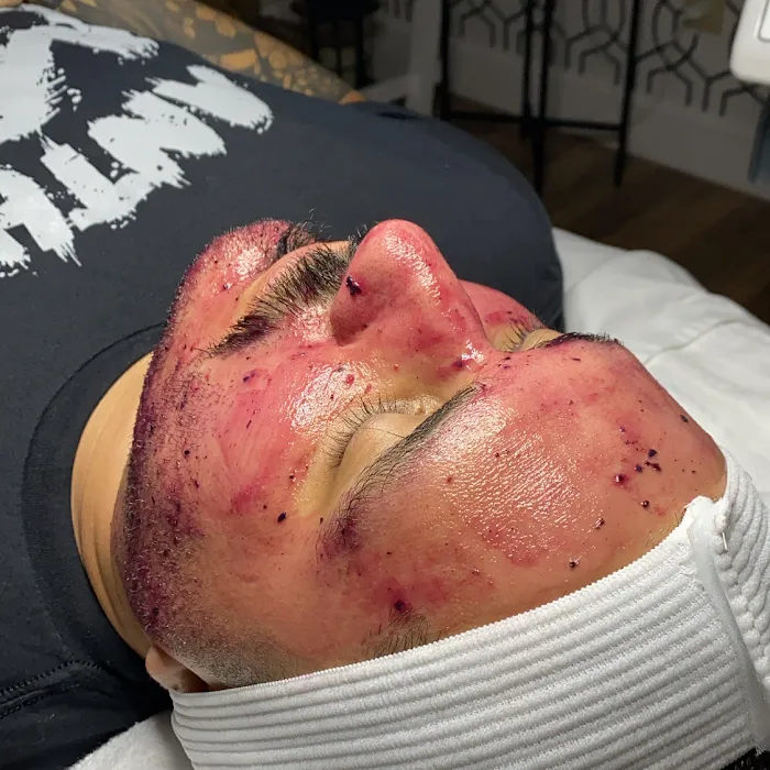 New Aura AestheTX Picture 10