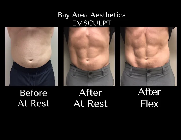 Bay Area Aesthetics Picture 9