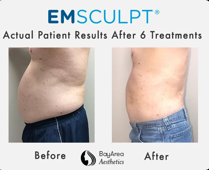 Bay Area Aesthetics Picture 5