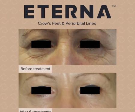 Elevate Medical Aesthetics