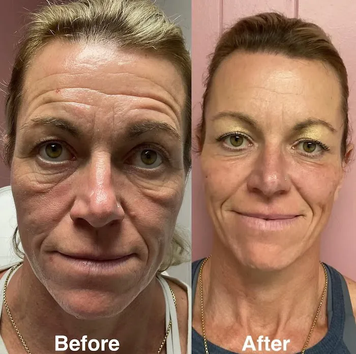 Elevate Medical Aesthetics Picture 3