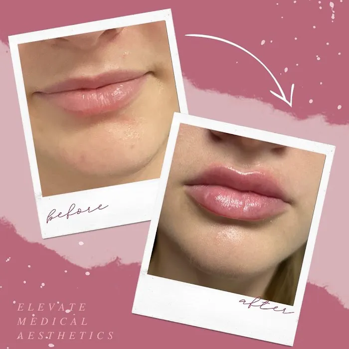 Elevate Medical Aesthetics Picture 2