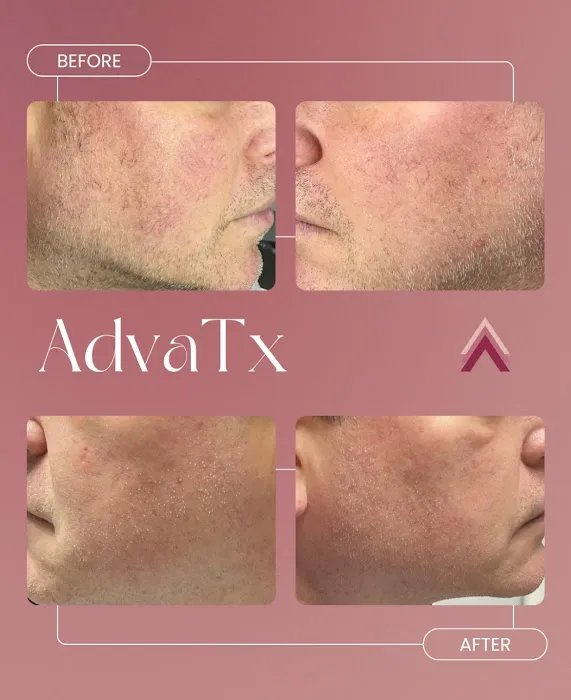 Elevate Medical Aesthetics Picture 9