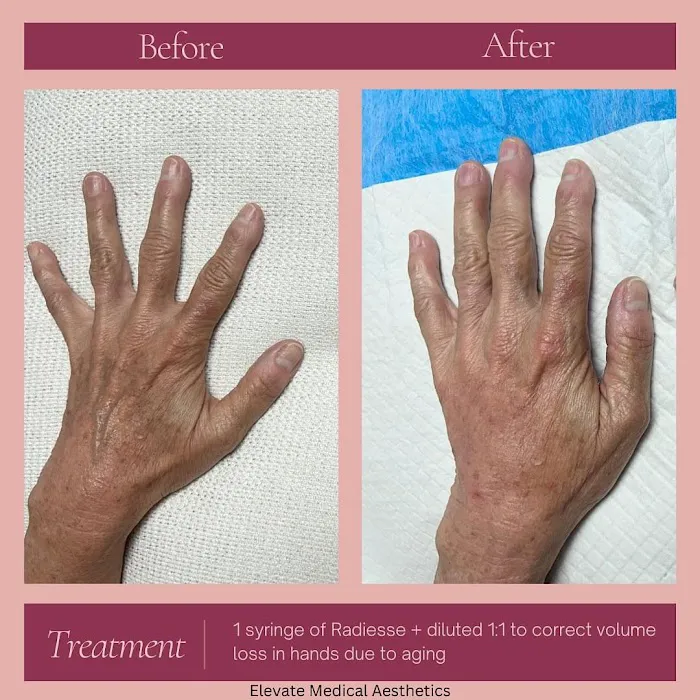 Elevate Medical Aesthetics Picture 7