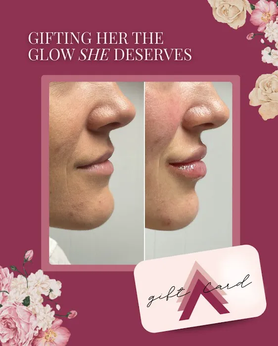 Elevate Medical Aesthetics Picture 8