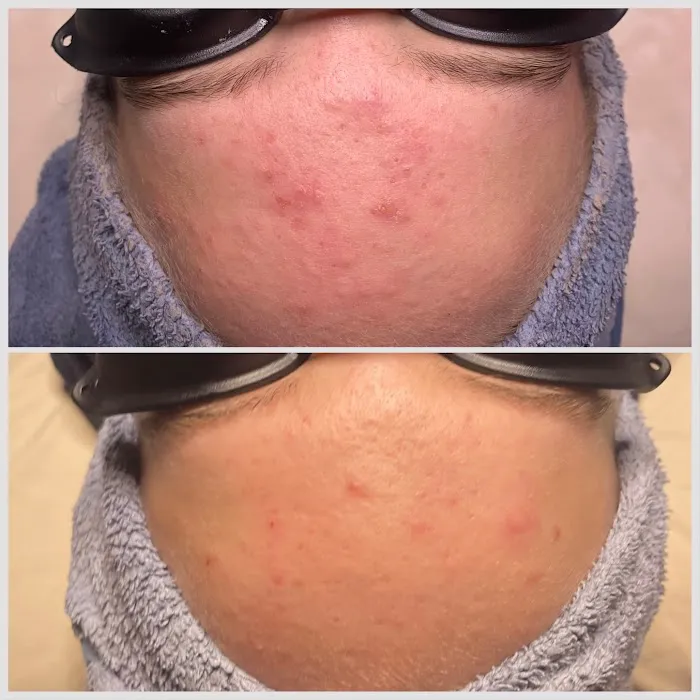 Advanced Skincare and Massage Picture 5