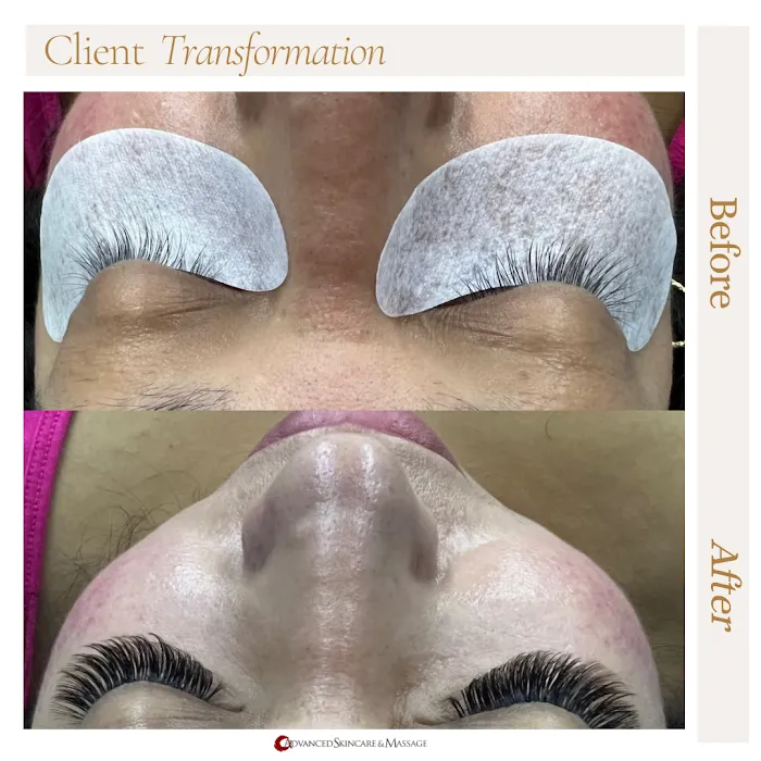 Advanced Skincare and Massage Picture 10