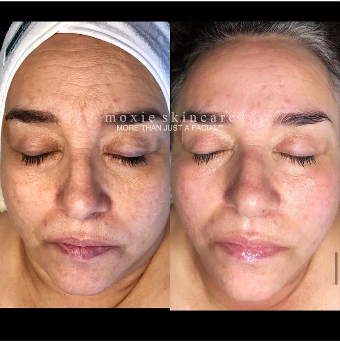 Moxie Skincare, LLC Picture 3
