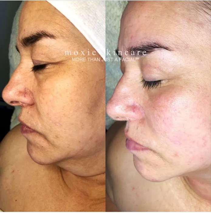 Moxie Skincare, LLC Picture 1