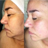 Moxie Skincare, LLC ico