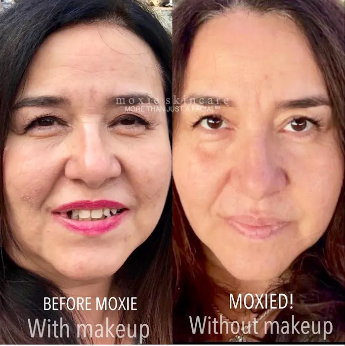 Moxie Skincare, LLC Picture 7