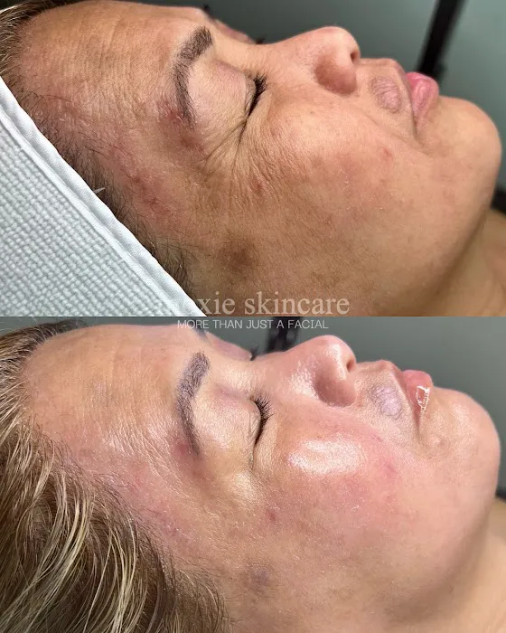 Moxie Skincare, LLC Picture 4