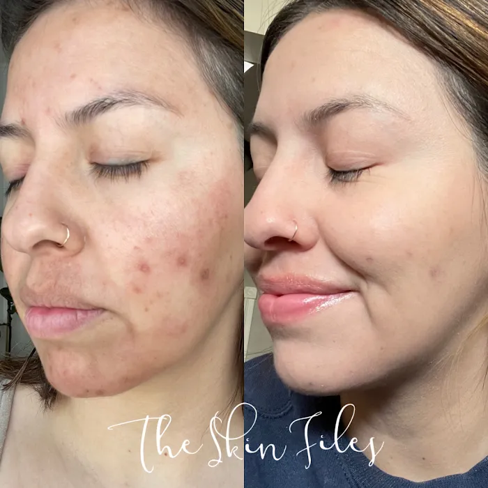 The Skin Files Picture 9