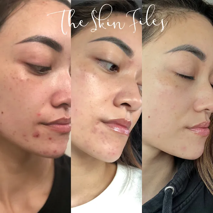 The Skin Files Picture 8