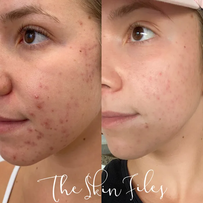 The Skin Files Picture 10