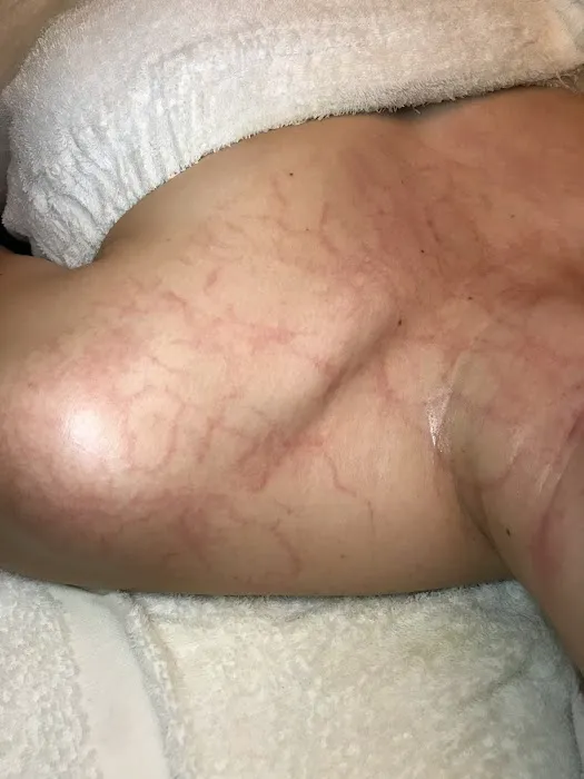 Invoke Skin Clinique Picture 10