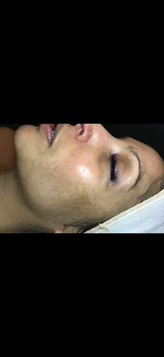 Invoke Skin Clinique Picture 4