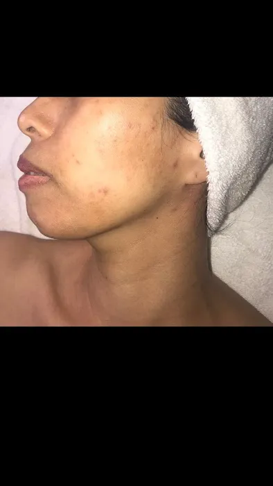 Invoke Skin Clinique Picture 7