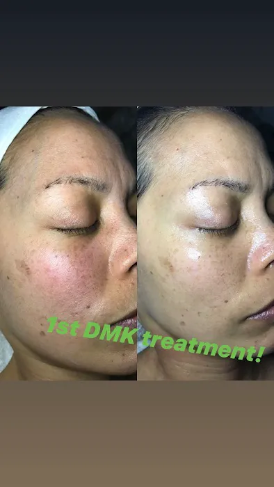 Invoke Skin Clinique Picture 6