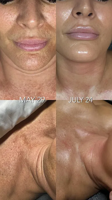 Jerry Shipman Skin Revision Picture 1