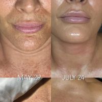 Jerry Shipman Skin Revision ico