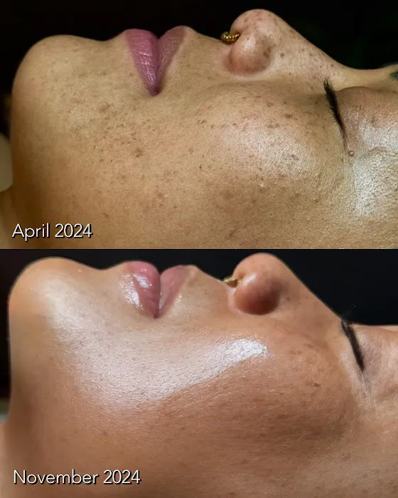 Jerry Shipman Skin Revision Picture 2