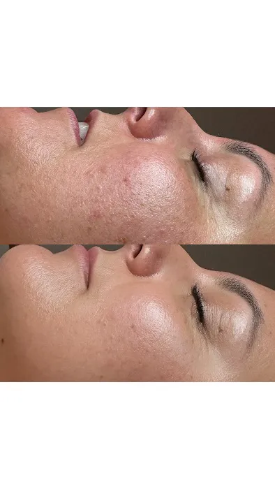 Jerry Shipman Skin Revision Picture 3