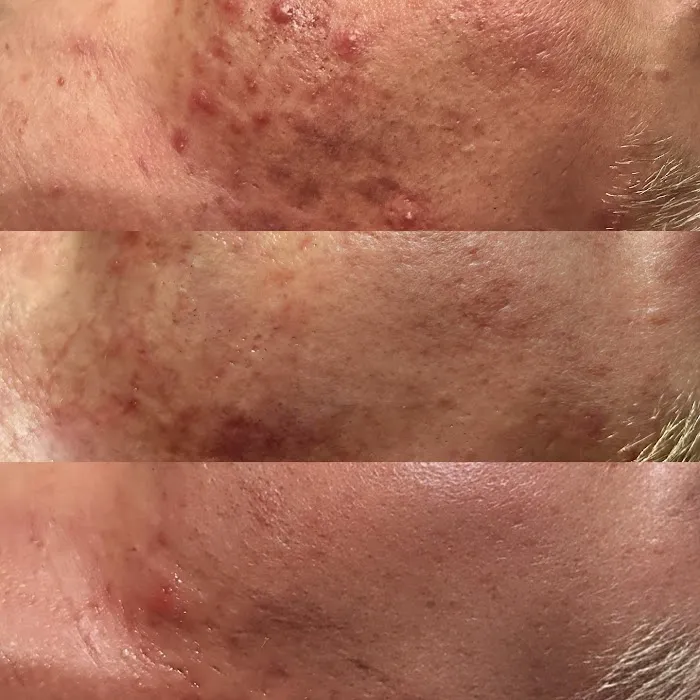 Jerry Shipman Skin Revision Picture 10