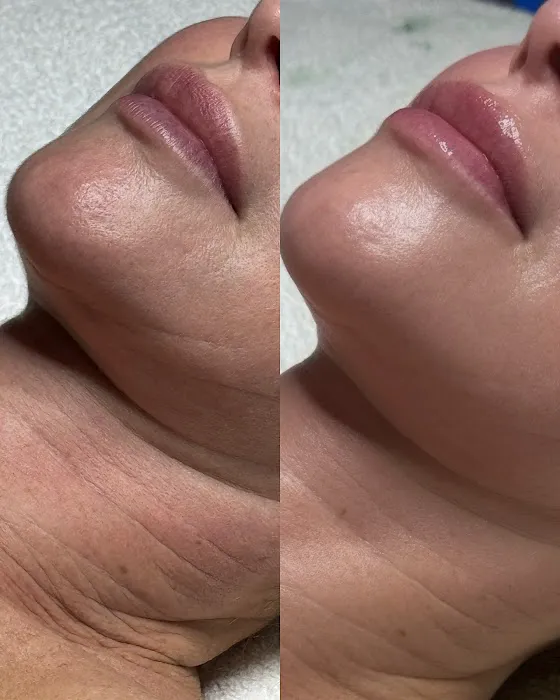 Jerry Shipman Skin Revision Picture 9