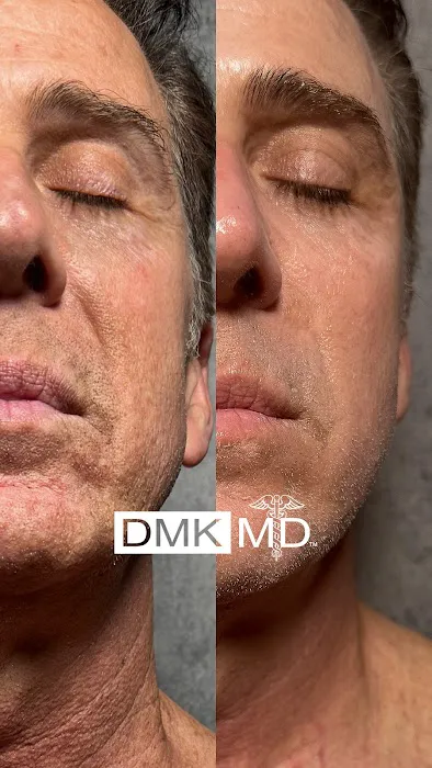 Jerry Shipman Skin Revision Picture 6