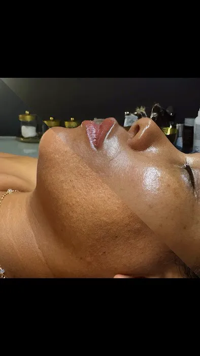 Jerry Shipman Skin Revision Picture 7