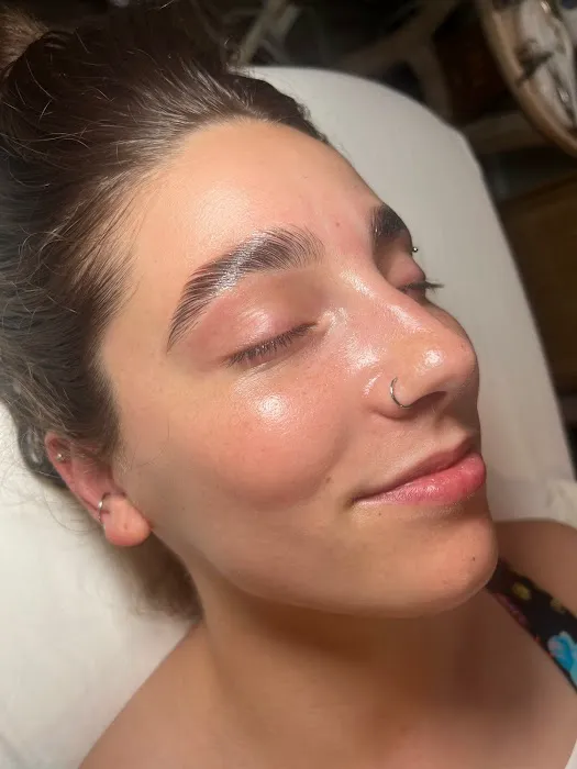 Martel Aesthetics Picture 8