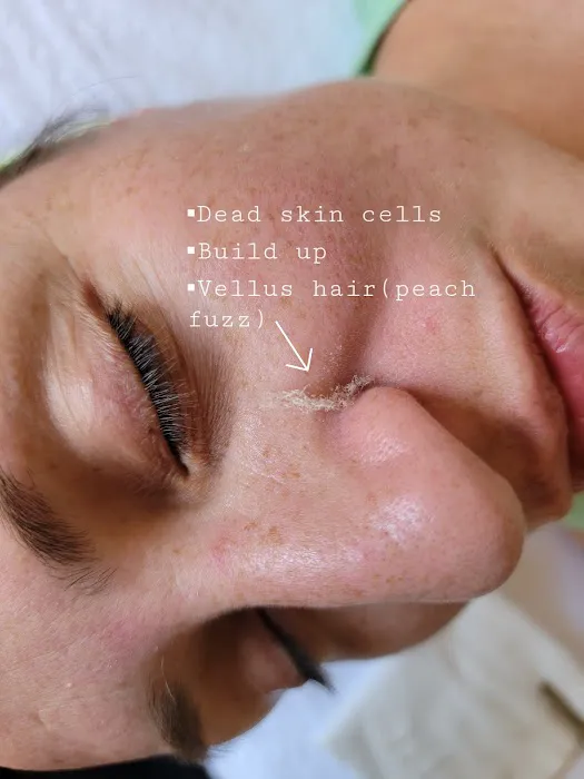 CHICÓTA SKIN Picture 3