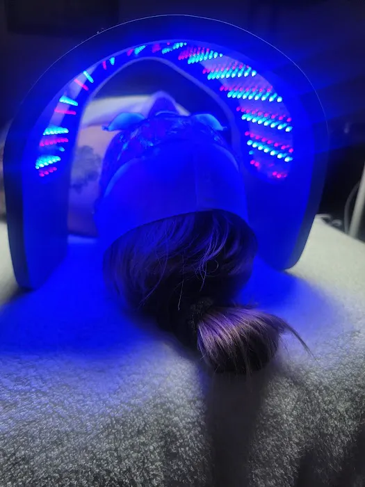 CHICÓTA SKIN Picture 4