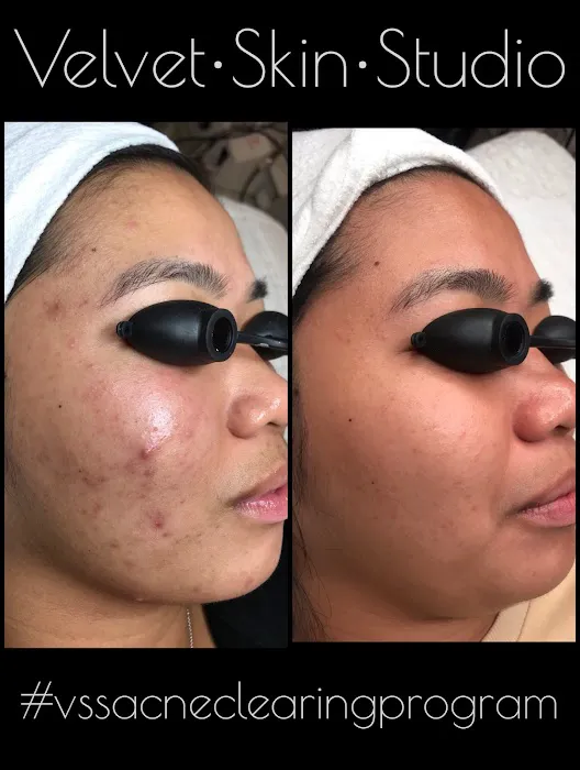 Velvet Skin Studio Picture 3