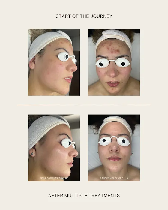 The Complexion Club Picture 5