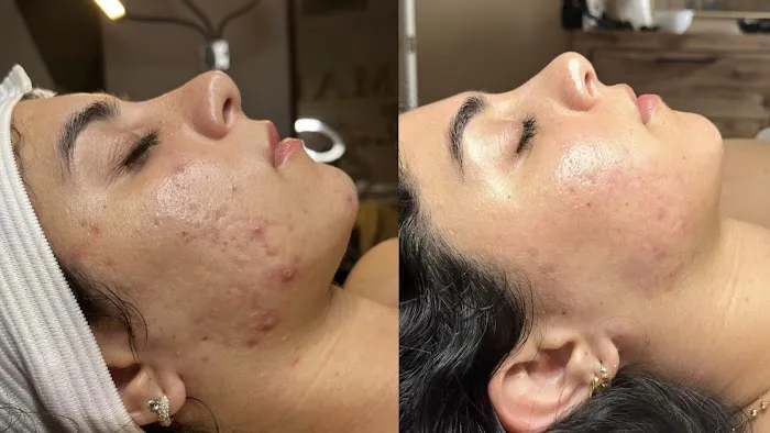 Samara Esthetics San Diego Picture 2