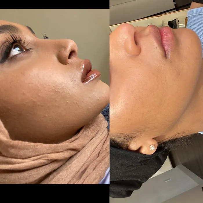 Samara Esthetics San Diego Picture 4