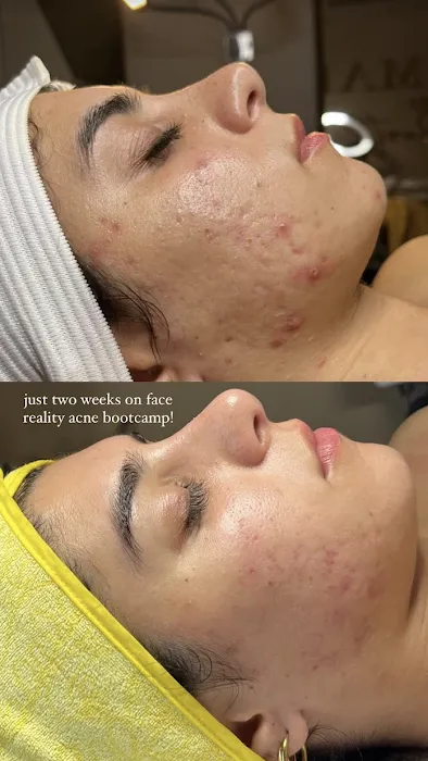 Samara Esthetics San Diego Picture 8